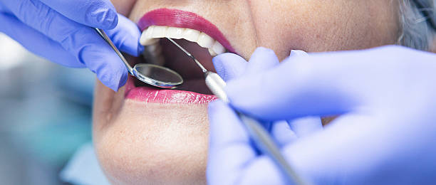 Best Emergency Tooth Extraction in Stockdale, TX